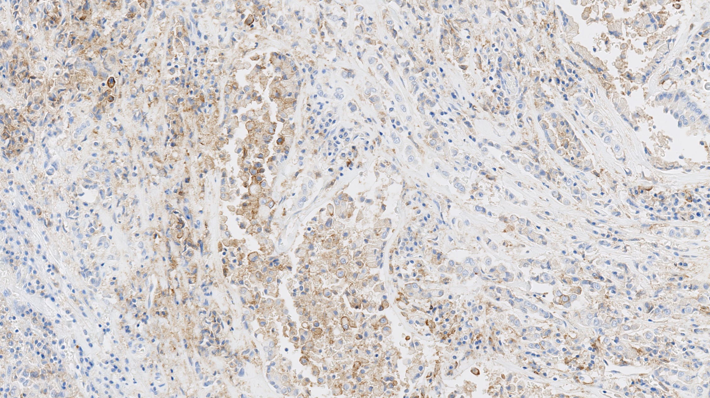 Immunohistochemical analysis of paraffin-embedded human lung